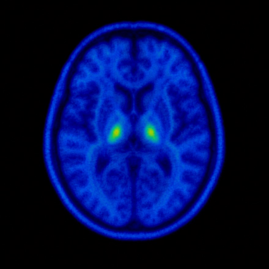 illustration of a brain with mostly low, cool activity during passive re-reading