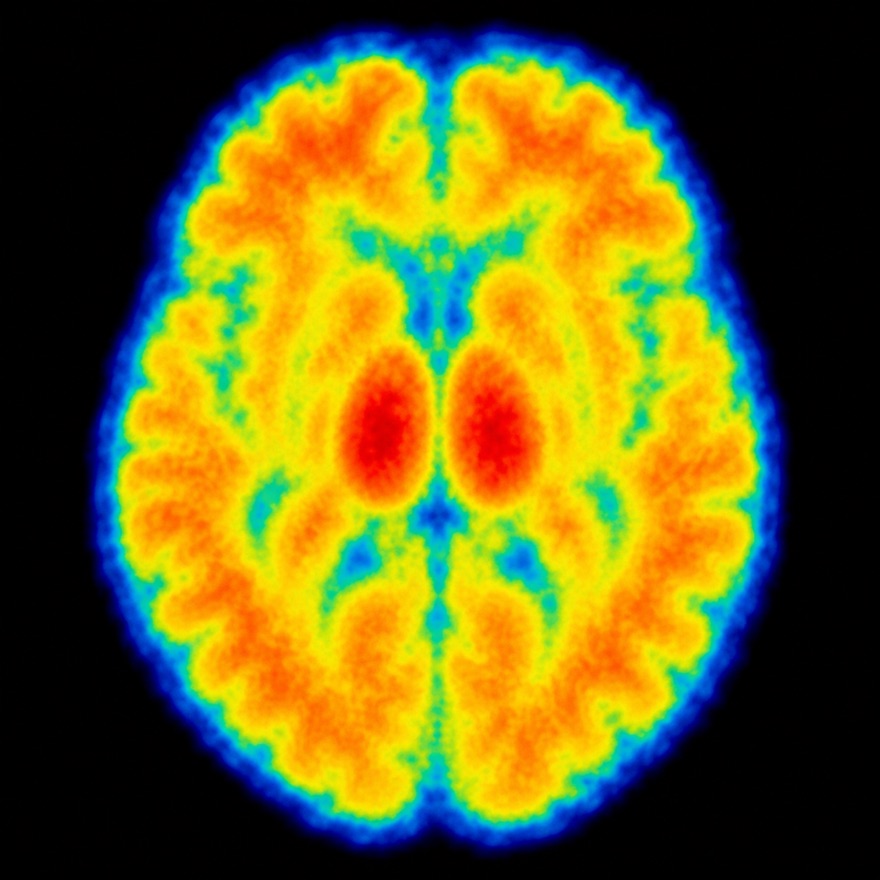 illustration of a brain lit up with widespread warm activity during active recall